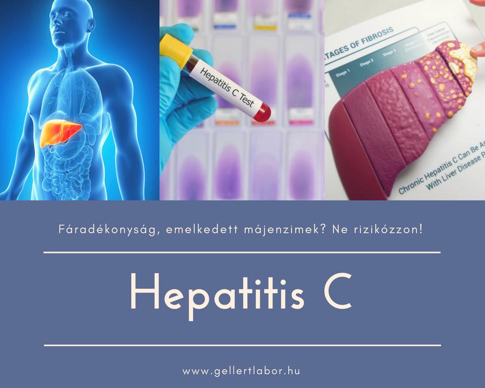 hepatitis c magas vérnyomás)