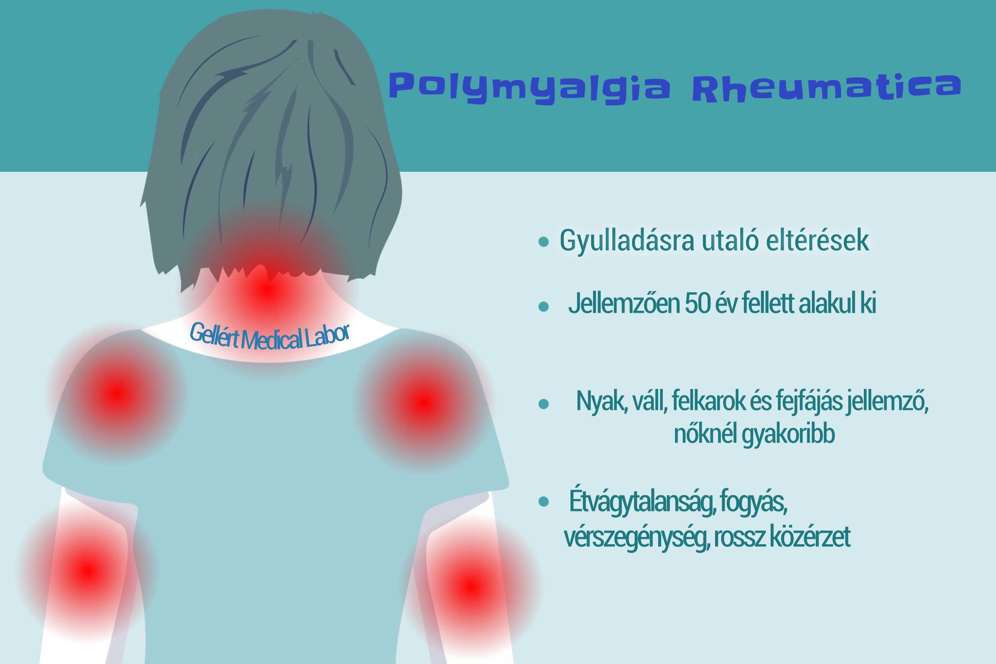 fogyás és polymyalgia rheumatica bronchiális asztma fogyás