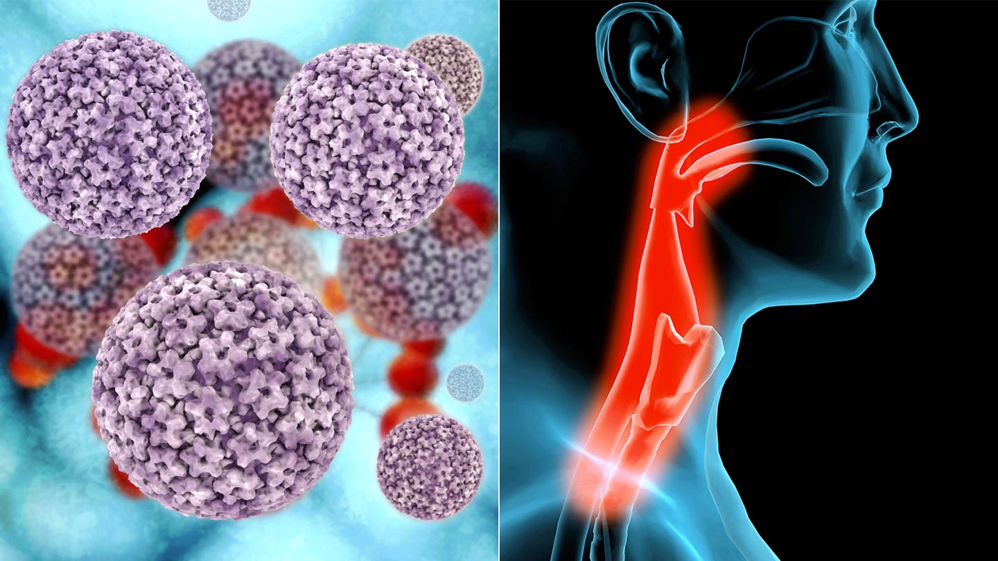 Átviteli papilloma vírus csók HPV tévhitek és tények